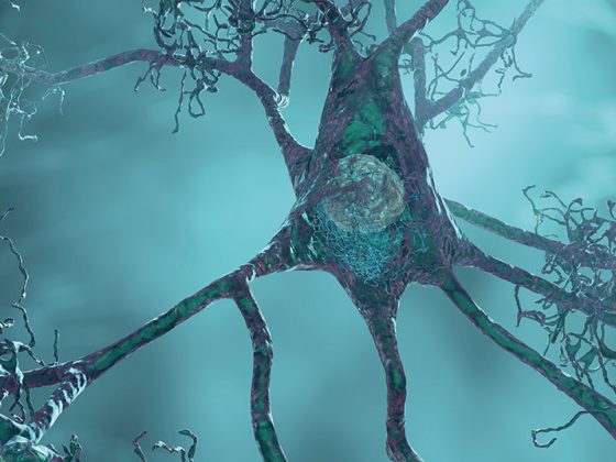 neuronen_istock-1330356953