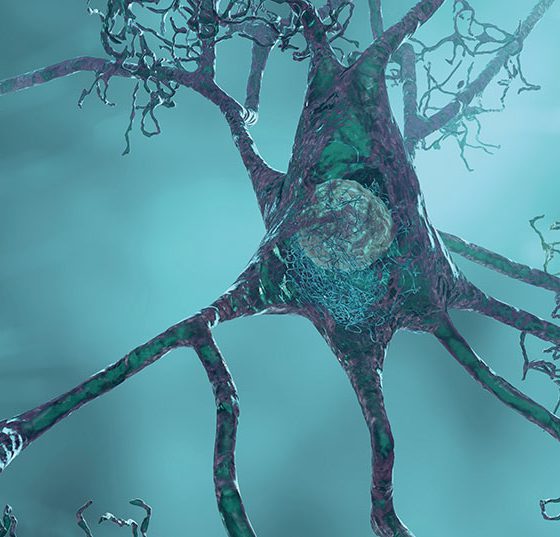 neuronen_istock-1330356953