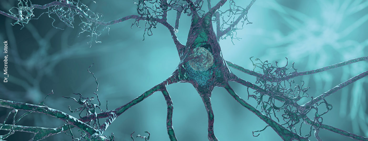 neuronen_istock-1330356953