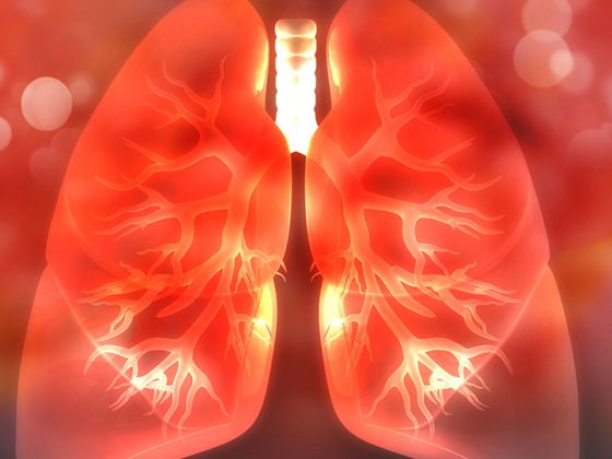 lunge_istock-1090820390