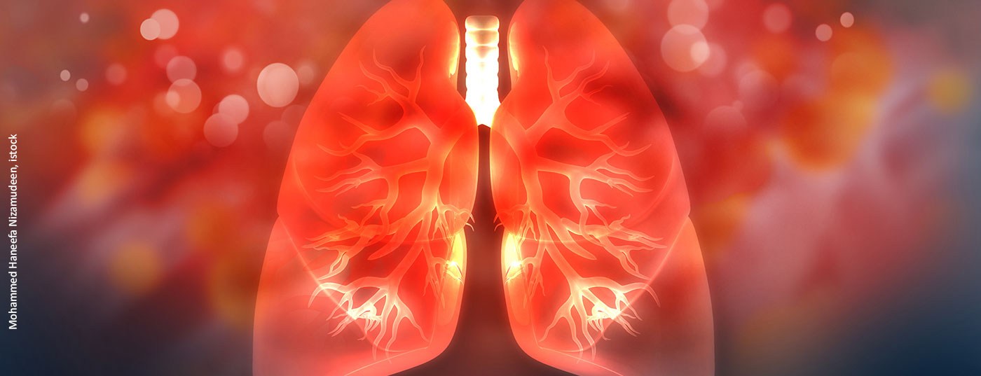 lunge_istock-1090820390