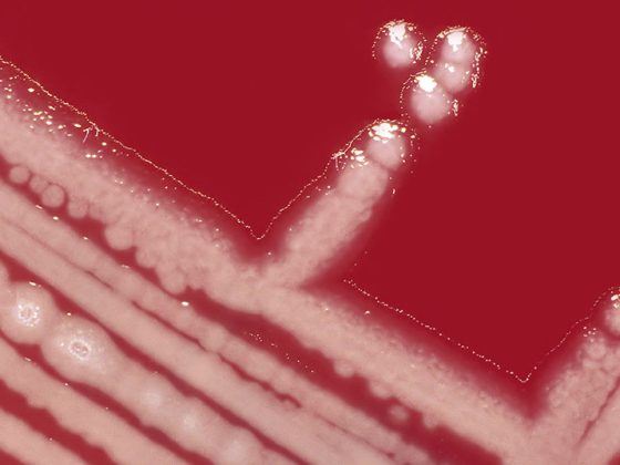 pseudomonas_arg_istock-92187427