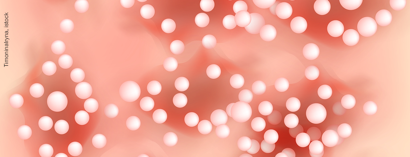 psoriasis-pustulosa_istock-1125250819