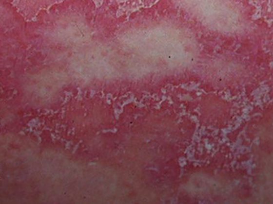 sneddwilk5_watermarkedwyjxyxrlcm1hcmtlzcjd