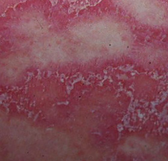 sneddwilk5_watermarkedwyjxyxrlcm1hcmtlzcjd