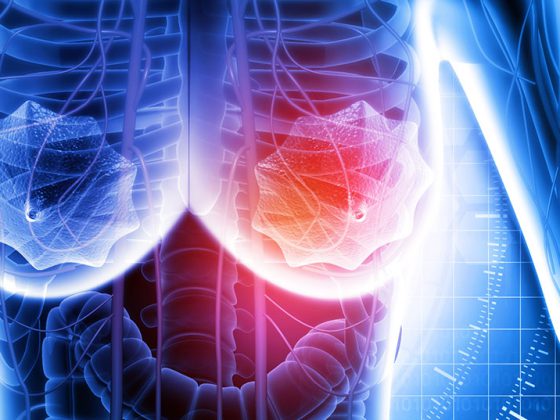 brustkrebs_istock-1273858064