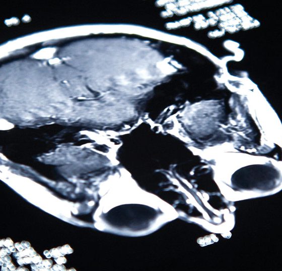 gehirn_istock-186871490