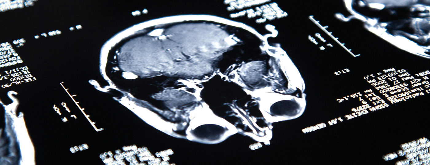 gehirn_istock-186871490