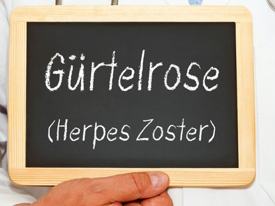 herpes_zoster_guertelrose