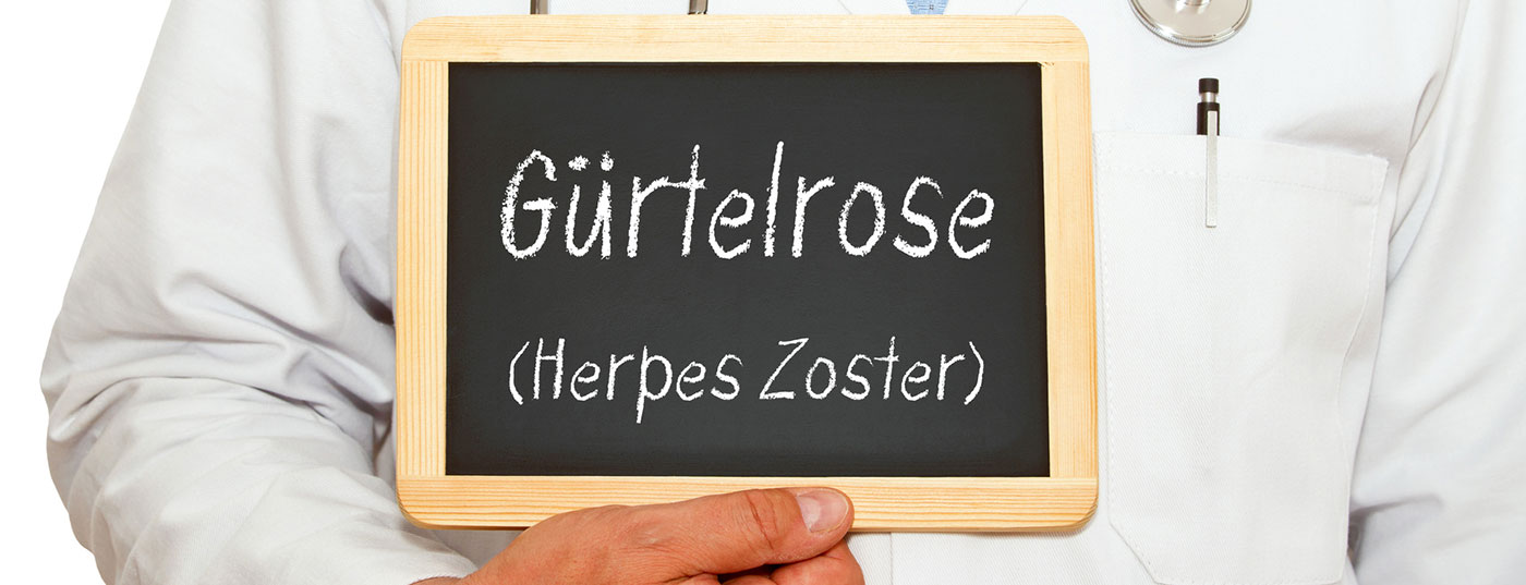 herpes_zoster_guertelrose