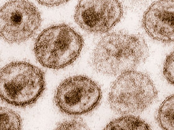 hiv-1_transmission_electron_micrograph_aids02bbb_lores