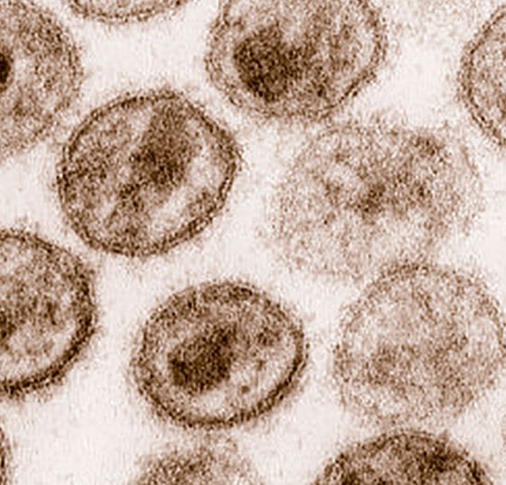 hiv-1_transmission_electron_micrograph_aids02bbb_lores