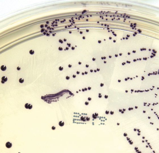 bakterien_infektion_wunde_istock-184277388