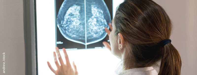 brustkrebs_istock-917730078
