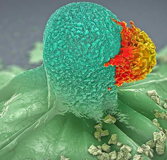 krebszelle_istock-980392876