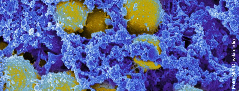 staphylococcus_aureus_bacteria_7739552618