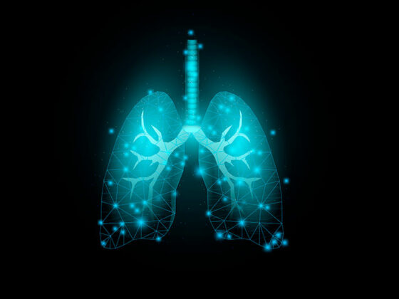 lunge_istock-1315298151