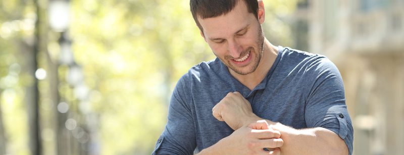 juckreiz_istock-1180289110