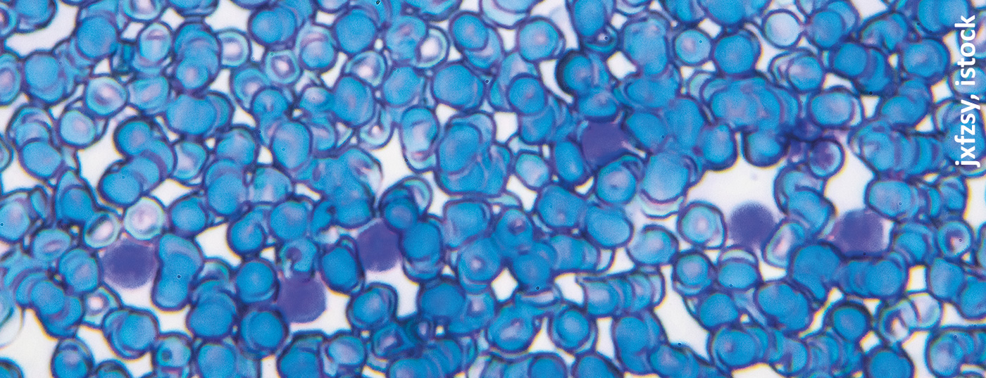 lymphome_istock-966659708