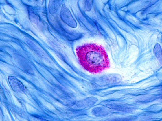 mastzelle_istock-1210206680