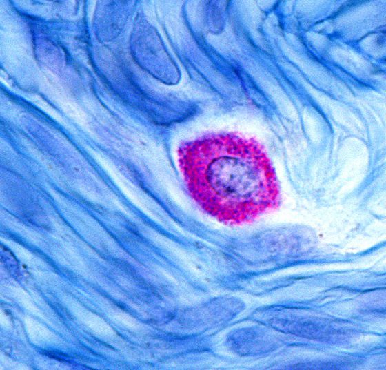 mastzelle_istock-1210206680