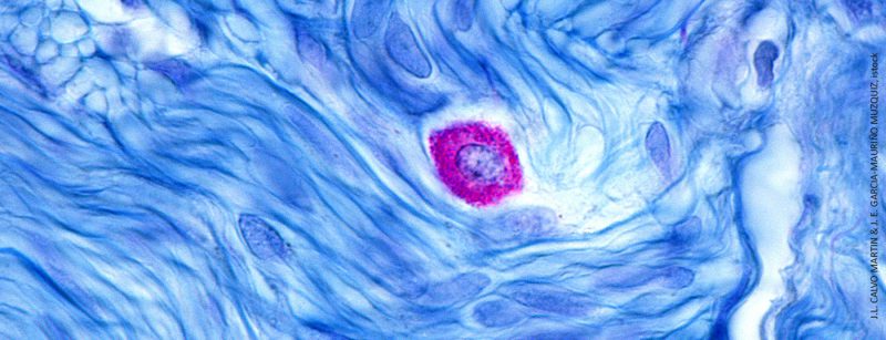 mastzelle_istock-1210206680