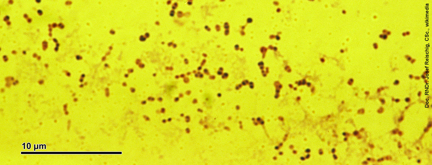 Pneumococcus
