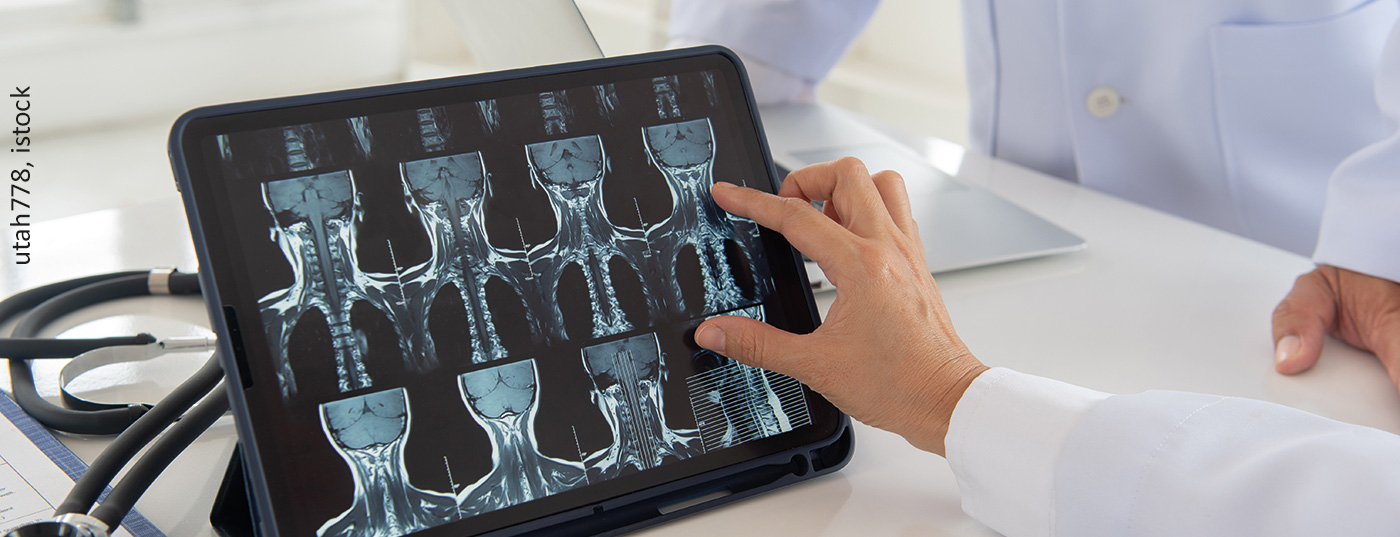 tumor_istock-1257153633