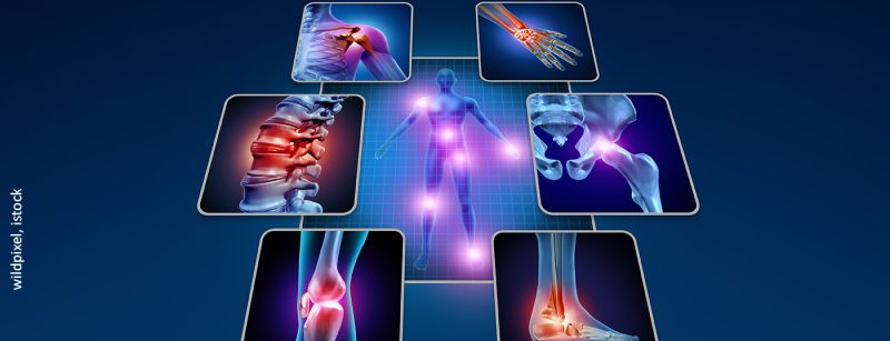 schmerz_istock-1194222045