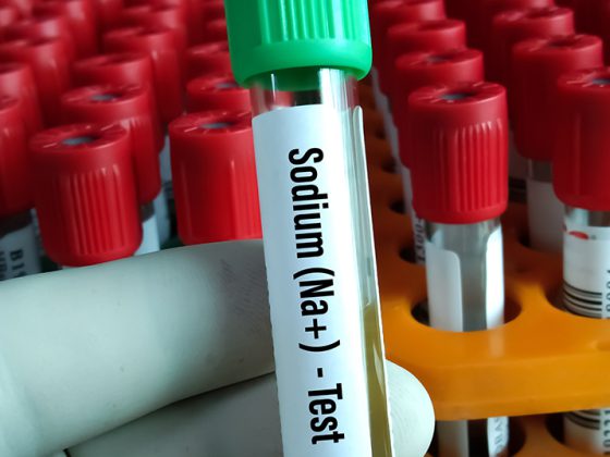 blut_natrium_istock-1340503120