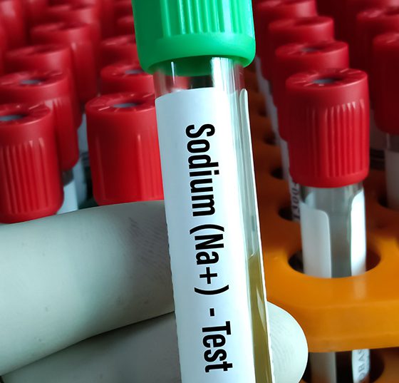 blut_natrium_istock-1340503120