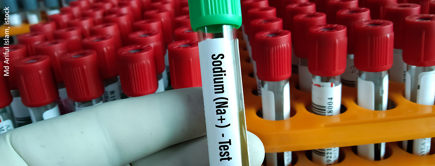 blut_natrium_istock-1340503120