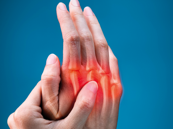 psoriasis-arthritis_istock-1165109879