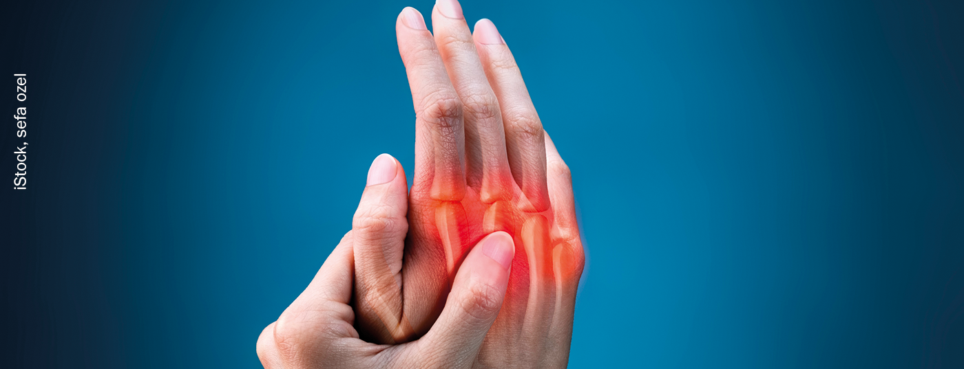 psoriasis-arthritis_istock-1165109879