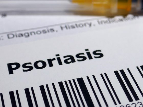 psoriasis_istock-1128839115