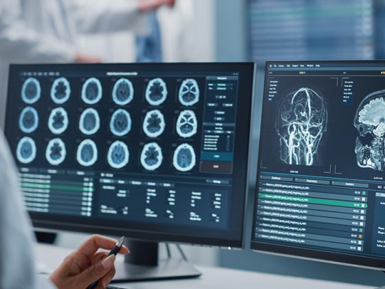 gehirn_istock-1388387555