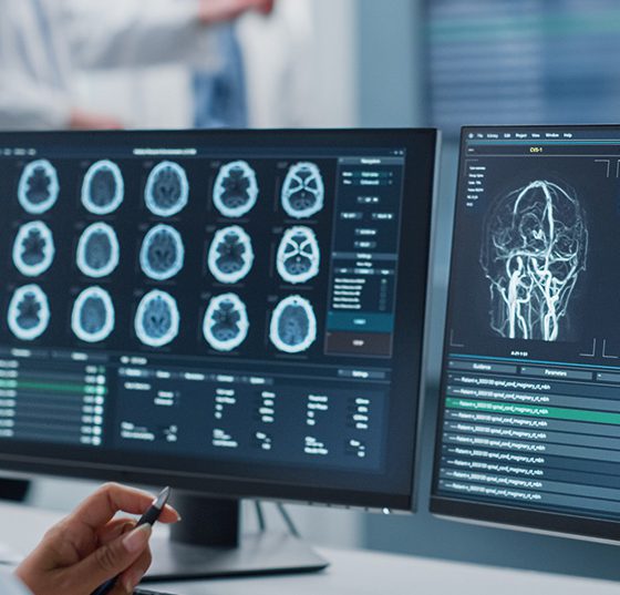 gehirn_istock-1388387555