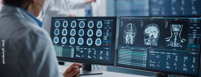 gehirn_istock-1388387555