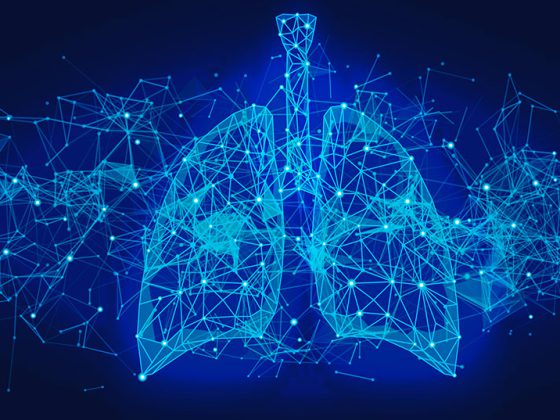 lunge_istock-1217093838