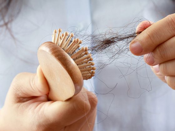 haarausfall_istock-1366387971