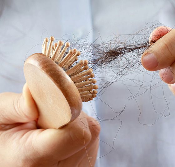 haarausfall_istock-1366387971