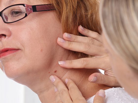 hautarzt_untersuchung_istock-840678048