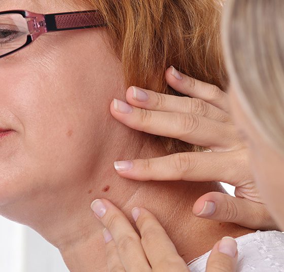 hautarzt_untersuchung_istock-840678048