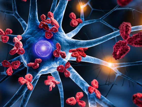 nervenzelle_ms_istock-1364982274