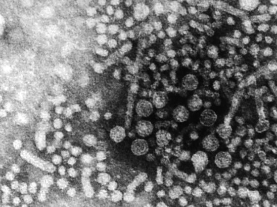 1cebe93cbfd64cbbaa57666d32170435q8seequ3d61xrvgj-0