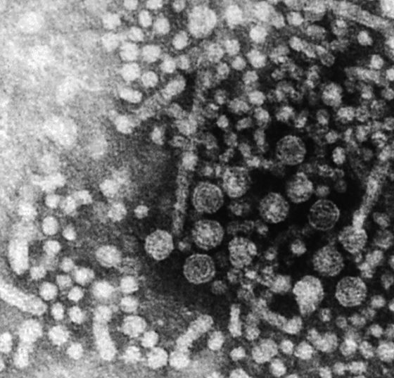 1cebe93cbfd64cbbaa57666d32170435q8seequ3d61xrvgj-0