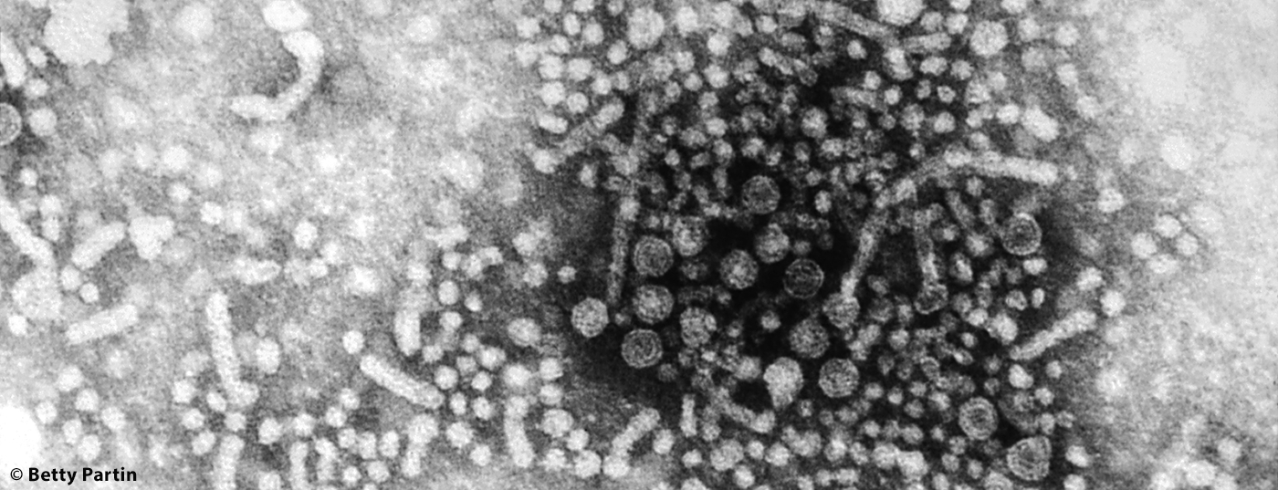 1cebe93cbfd64cbbaa57666d32170435q8seequ3d61xrvgj-0