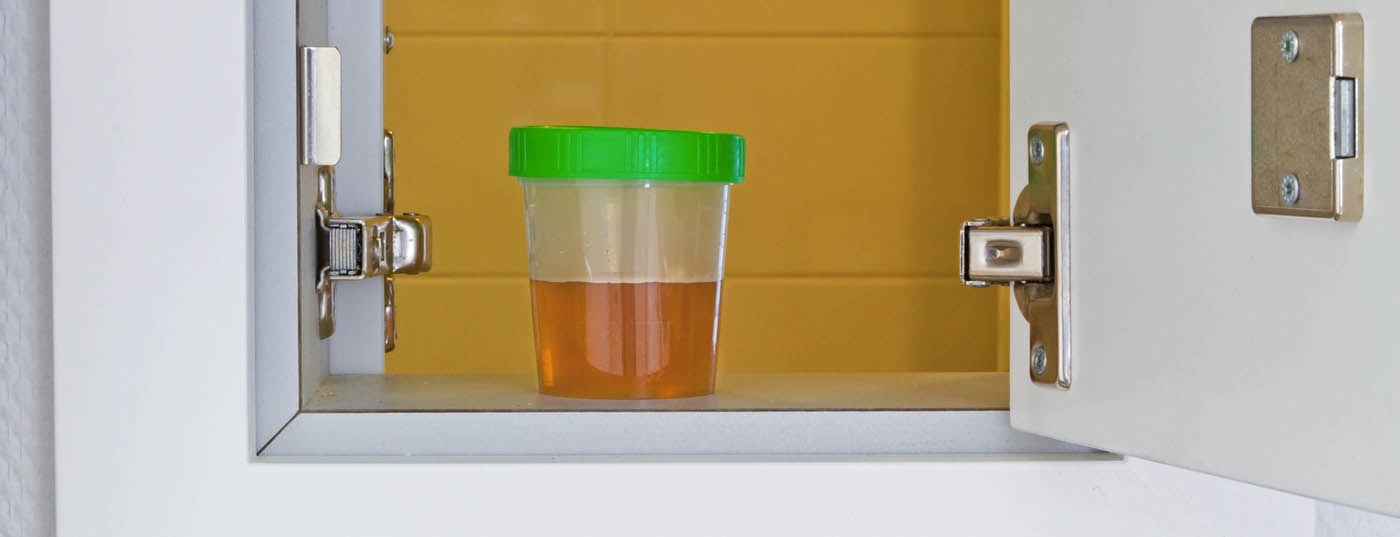 urin_harn_blase_urinprobe