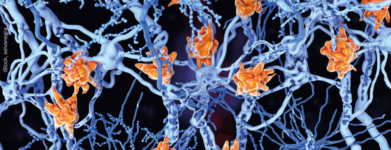 nerven_ms_istock-1141952174